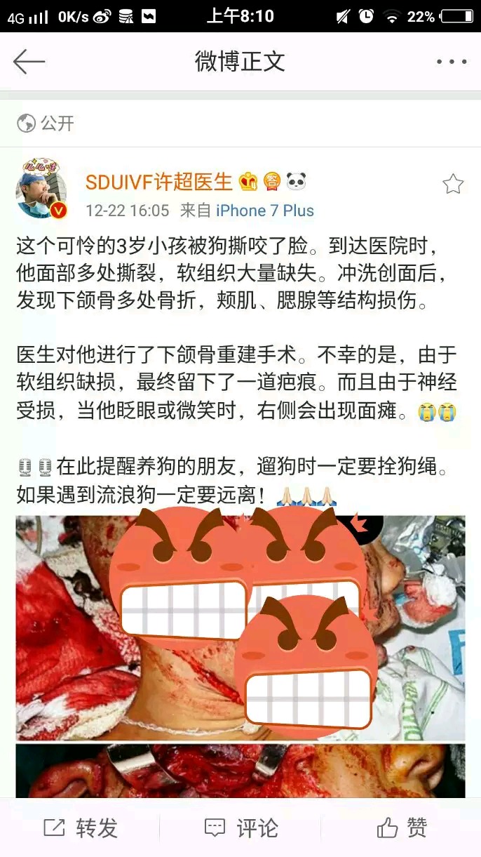 B272C2E96DFB530516B9772A9A18BBDD.jpg