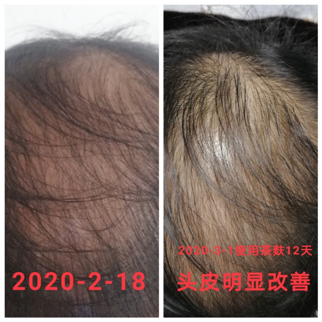 mmexport1583067853017.jpg