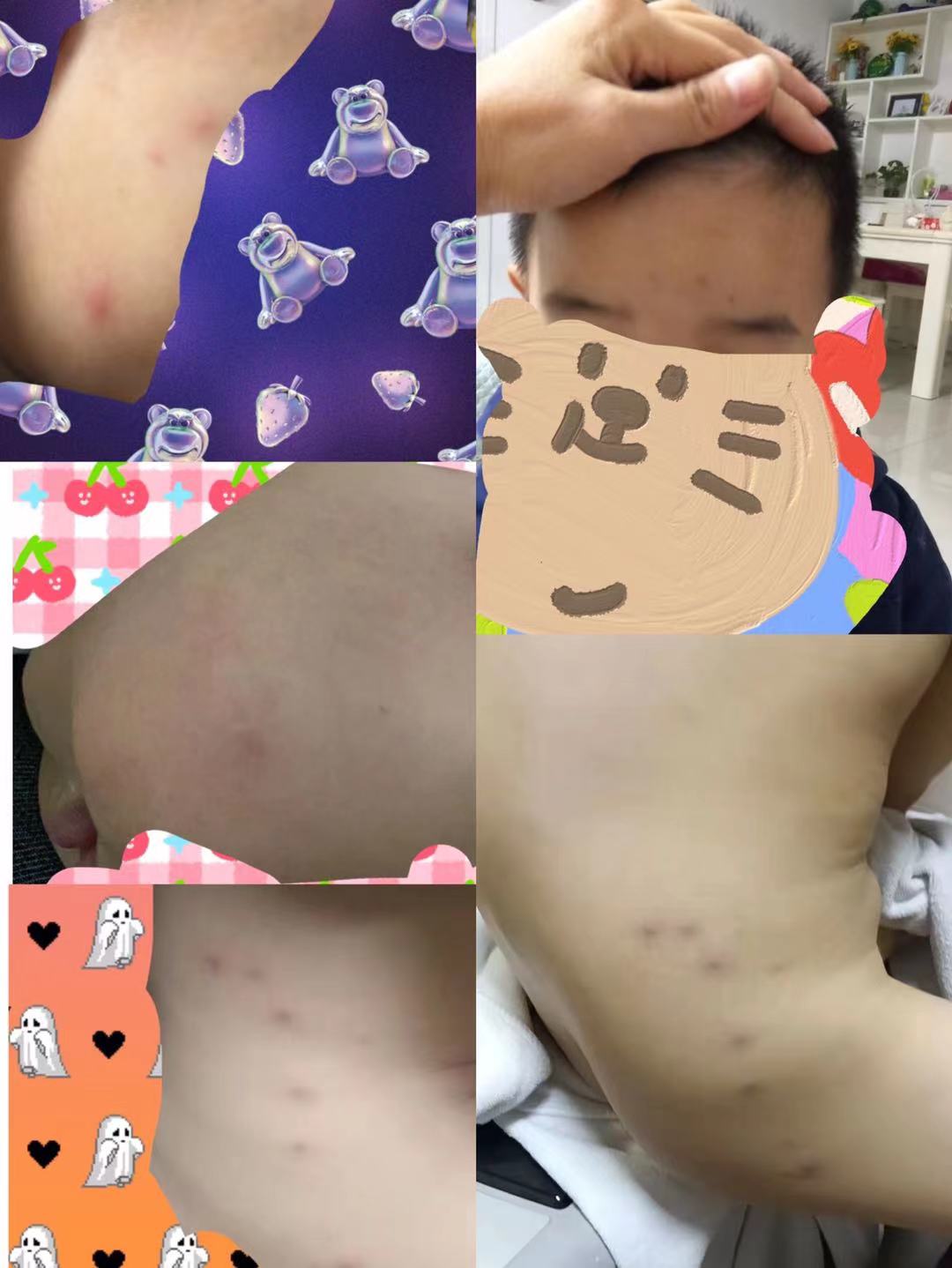 都是被叮咬的