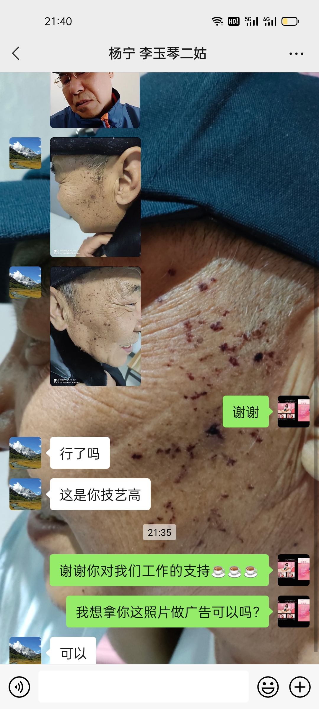 wechat_upload163912837961b31d3b260db